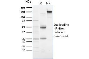SDS-PAGE Analysis Purified PLK1 Mouse Monoclonal Antibody (AZ44). (PLK1.S Antikörper)
