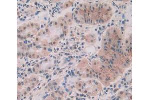 Used in DAB staining on fromalin fixed paraffin- embedded stomach tissue (PPP1CA Antikörper  (AA 2-330))