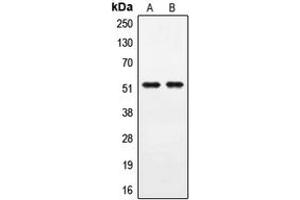 Western blot analysis of PPHLN1 expression in A549 (A), COLO205 (B) whole cell lysates. (PPHLN1 Antikörper  (Center))