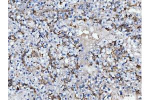 IHC analysis of CD14 using anti-CD14 antibody (ABIN7600531). (CD14 Antikörper  (AA 20-259))