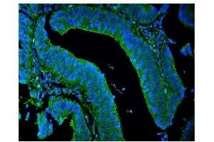 anti-Lipoma-preferred partner (LPP) (C-Term) antibody