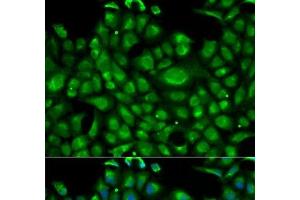 Immunofluorescence analysis of U2OS cells using HSPA1L Polyclonal Antibody (HSPA1L Antikörper)