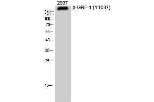 Western Blotting (WB) image for anti-Glucocorticoid Receptor DNA Binding Factor 1 (GRLF1) (pTyr1087) antibody (ABIN3182020) (GRLF1 Antikörper  (pTyr1087))
