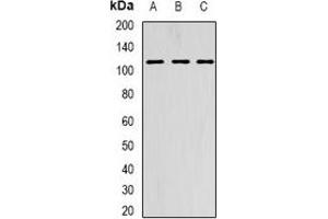 Western blot analysis of AARS2 expression in HepG2 (A), SKOV3 (B), MCF7 (C) whole cell lysates. (AARS2 Antikörper)