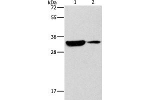 Western Blot analysis of Mouse heart and brain tissue using DSCR1 Polyclonal Antibody at dilution of 1:500 (RCAN1 Antikörper)