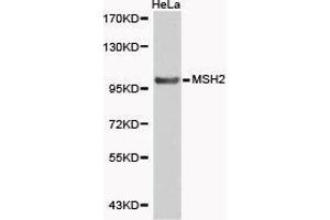 Western Blotting (WB) image for anti-Mismatch Repair Protein 2 (MSH2) antibody (ABIN1873750) (MSH2 Antikörper)