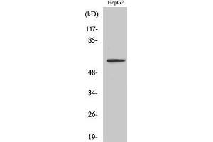 Western Blotting (WB) image for anti-Interleukin 20 Receptor alpha (IL20RA) (Internal Region) antibody (ABIN3185168) (IL20RA Antikörper  (Internal Region))