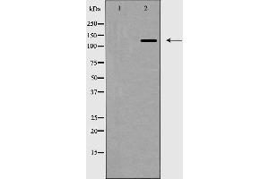 Western blot analysis of ZEB2 expression in HepG2 cell lysate,The lane on the left is treated with the antigen-specific peptide. (ZEB2 Antikörper  (N-Term))