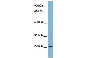HSD17B14 antibody used at 1 ug/ml to detect target protein. (HSD17B14 Antikörper)