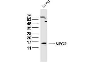 Mouse Lung lysates probed with NPC2 Polyclonal Antibody, Unconjugated  at 1:300 dilution and 4˚C overnight incubation. (NPC2 Antikörper  (AA 20-80))