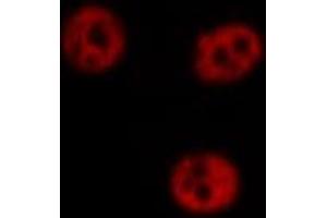 ABIN6266711 staining Hela by IF/ICC. (AKAP8 Antikörper  (Internal Region))