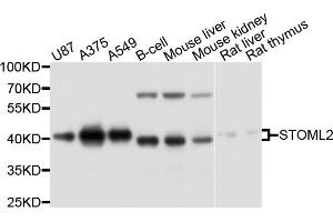 Western blot analysis of extracts of various cell lines, using STOML2 antibody. (STOML2 Antikörper)