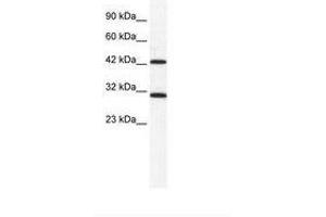 Image no. 1 for anti-DEAD (Asp-Glu-Ala-Asp) Box Polypeptide 39A (DDX39) (N-Term) antibody (ABIN203128) (DDX39 Antikörper  (N-Term))