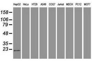 Image no. 2 for anti-Adenylate Kinase 1 (AK1) antibody (ABIN1496517) (Adenylate Kinase 1 Antikörper)