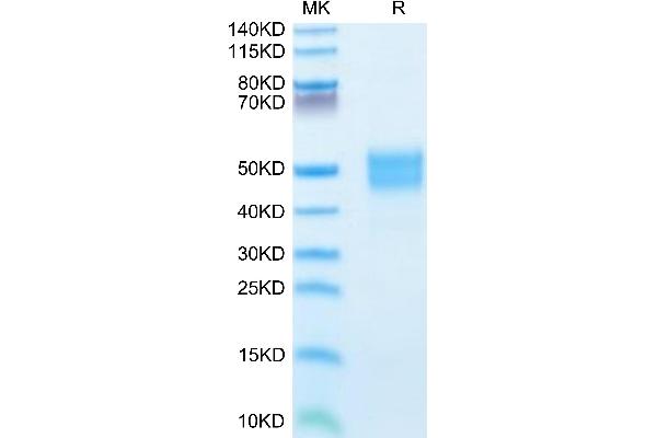 IGFBP3 Protein (AA 28-291) (His tag)