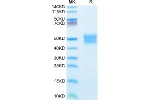 Human IGFBP-3 on Tris-Bis PAGE under reduced condition.