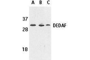 Western Blotting (WB) image for anti-RING1 and YY1 Binding Protein (RYBP) (AA 215-228) antibody (ABIN2473292) (RYBP Antikörper  (AA 215-228))