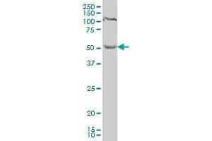 PDCD7 monoclonal antibody (M01), clone 3H5 Western Blot analysis of PDCD7 expression in HeLa . (PDCD7 Antikörper  (AA 47-146))