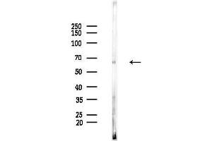 anti-T-Box 15/18 (TBX15/18) antibody