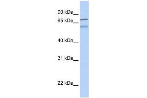 WB Suggested Anti-ZNF671 Antibody Titration:  0. (ZNF671 Antikörper  (N-Term))