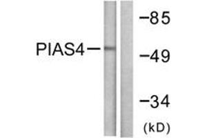 Western blot analysis of extracts from Jurkat cells, using PIAS4 Antibody. (PIAS4 Antikörper  (AA 451-500))