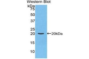 Western blot analysis of the recombinant protein. (Prothrombin Antikörper  (AA 44-200))