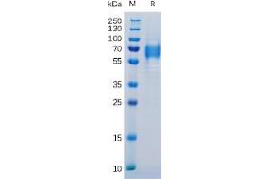 Human IL6R Protein, His Tag on SDS-PAGE under reducing condition. (IL-6 Receptor Protein (His tag))
