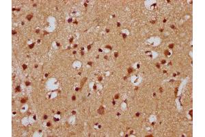 IHC image of ABIN7165594 diluted at 1:300 and staining in paraffin-embedded human brain tissue performed on a Leica BondTM system. (FEV Antikörper  (AA 1-97))