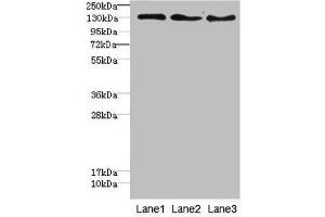 Western blot All lanes: RBP2antibody at 1. (RBP2 Antikörper  (AA 1-134))