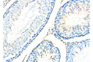 ABIN6259048 and ABIN6274810 at 1/100 staining Rat brain tissue by IHC-P.