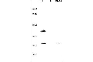 Lane 1: mouse testis lysates Lane 2: mouse brain lysates probed with Anti RSPO1 Polyclonal Antibody, Unconjugated (ABIN715451) at 1:200 in 4 °C. (RSPO1 Antikörper)