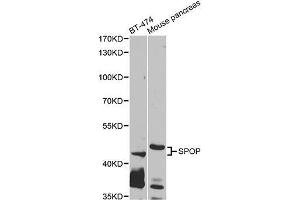 Western blot analysis of extracts of various cell lines, using SPOP antibody (ABIN5995544) at 1/1000 dilution. (SPOP-B Antikörper)