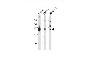 All lanes : Anti-GSTM4 Antibody (N-term) at 1:2000 dilution Lane 1: Human liver tissue lysate Lane 2: MCF-7 whole cell lysate Lane 3: SK-BR-3 whole cell lysate Lysates/proteins at 20 μg per lane.