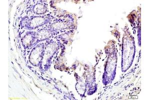 Immunohistochemistry (Paraffin-embedded Sections) (IHC (p)) image for anti-Tumor Necrosis Factor (Ligand) Superfamily, Member 18 (TNFSF18) (AA 101-199) antibody (ABIN740535)