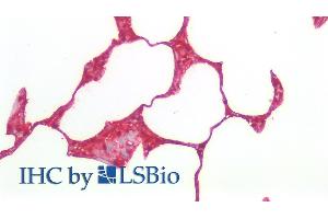 Immunohistochemistry (IHC) image for anti-S100 Calcium Binding Protein A6 (S100A6) (AA 1-89) antibody (ABIN7437005)