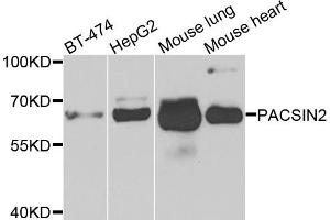 Western blot analysis of extracts of various cells, using PACSIN2 antibody. (PACSIN2 Antikörper)