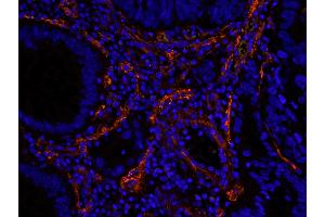 Immunofluorescence (IF) image for anti-Filamin A, alpha (FLNA) (AA 1725-1775) antibody (ABIN7448965) (Filamin A Antikörper  (AA 1725-1775))