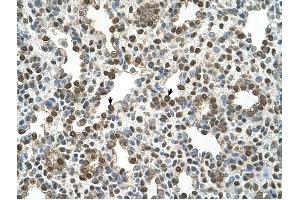 OSBPL9 antibody was used for immunohistochemistry at a concentration of 4-8 ug/ml to stain Alveolar cells (arrows) in Human Lung. (OSBPL9 Antikörper  (N-Term))