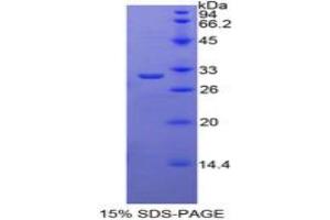 SDS-PAGE analysis of Mouse TRADD Protein. (TRADD Protein)