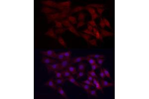 Immunofluorescence analysis of NIH/3T3 cells using WDR45 Rabbit pAb (ABIN6133064, ABIN6150194, ABIN6150195 and ABIN6223490) at dilution of 1:100 (40x lens). (WDR45 Antikörper  (AA 1-360))