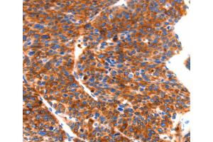 Immunohistochemistry (IHC) image for anti-Septin 4 (SEPT4) antibody (ABIN2432617) (Septin 4 Antikörper)