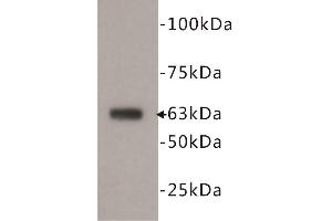 Western Blotting (WB) image for anti-5'-Nucleotidase, Ecto (CD73) (NT5E) antibody (ABIN1854862) (CD73 Antikörper)