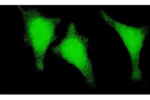 Immunofluorescence of monoclonal antibody to STAU1 on HeLa cell. (STAU1/Staufen Antikörper  (AA 401-496))
