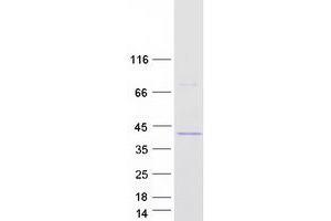 Validation with Western Blot (ATP8B2 Protein (Transcript Variant 2) (Myc-DYKDDDDK Tag))