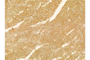 CDK5RAP1 Mouse Monoclonal Antibody at 1/100 staining rat heart tissue by IHC-P. (CDK5RAP1 Antikörper  (C-Term))