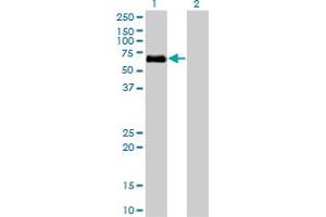 Western Blot analysis of BMPR1A expression in transfected 293T cell line by BMPR1A monoclonal antibody (M01), clone 4C4. (BMPR1A Antikörper  (AA 1-532))