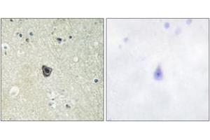 Immunohistochemistry analysis of paraffin-embedded human brain tissue, using CSFR (Ab-809) Antibody. (CSF1R Antikörper  (AA 781-830))