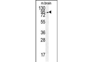Western Blotting (WB) image for anti-GIT1 (GIT1) (AA 366-395) antibody (ABIN5533601)