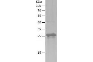 Western Blotting (WB) image for Transcription Factor AP-2 alpha (Activating Enhancer Binding Protein 2 Alpha) (TFAP2A) (AA 213-437) protein (His tag) (ABIN7125441) (TFAP2A Protein (AA 213-437) (His tag))