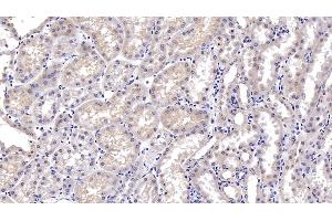 Detection of DTYMK in Porcine Kidney Tissue using Monoclonal Antibody to Deoxythymidylate Kinase (DTYMK) (DTYMK Antikörper  (AA 43-190))